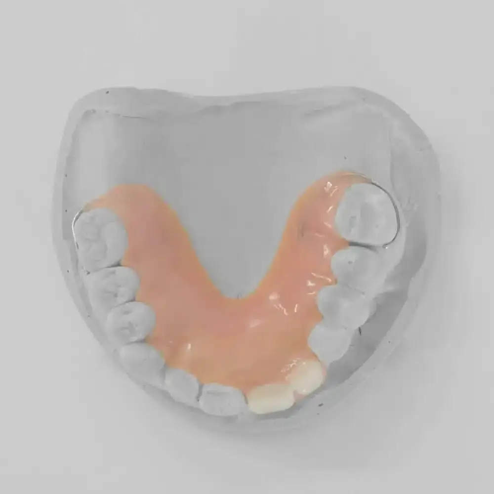 1-2 Tooth Replacement Acrylic Partial - Dentist Directed  - Impression Kit Included - Image 8
