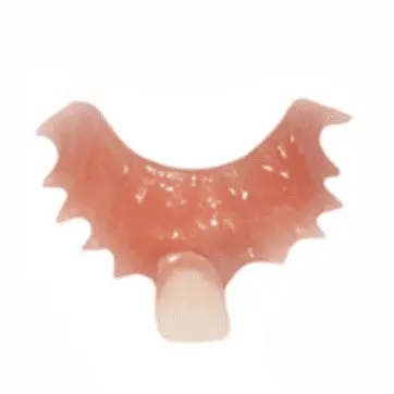 1-2 Tooth Replacement Acrylic Partial - Dentist Directed  - Impression Kit Included - Image 9