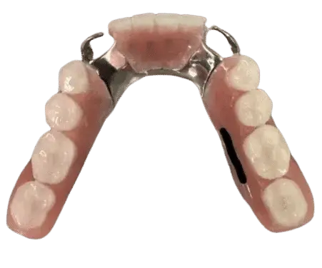 Metal Partial Dentures - Dentist Directed  - Impression Kit Included - Image 6