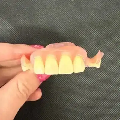 Flexible Partial Dentures - Dentist Directed  - Impression Kit Included - Image 10
