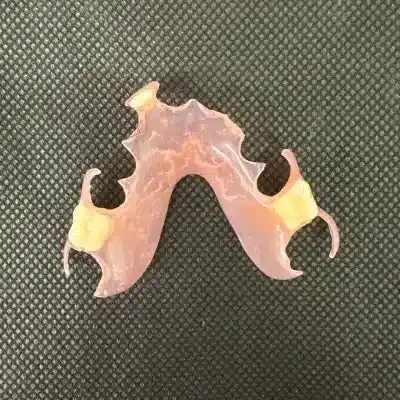 Flexible Partial Dentures - Dentist Directed  - Impression Kit Included - Image 8