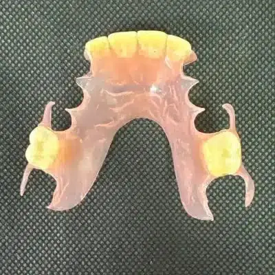 Flexible Partial Dentures - Dentist Directed  - Impression Kit Included - Image 9
