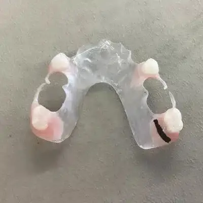 VisiClear Partial Dentures - Dentist Directed  - Impression Kit Included - Image 5