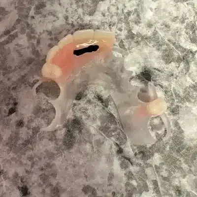 VisiClear Partial Dentures - Dentist Directed  - Impression Kit Included - Image 8