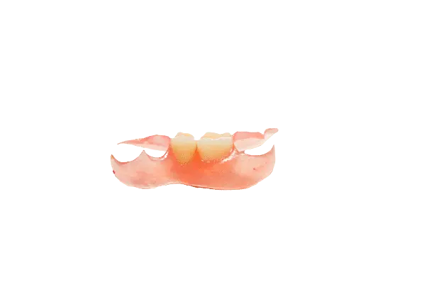 Unilateral Partial 1-3 Teeth - Dentist Directed  - Impression Kit Included - Image 5