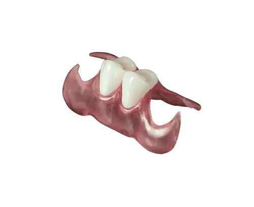 Unilateral Partial 1-3 Teeth - Dentist Directed  - Impression Kit Included - Image 9